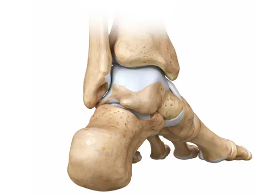 Ankle replacement