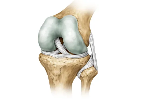 Knee replacement surgery