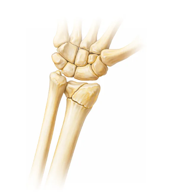Why radius fractures require a precise approach