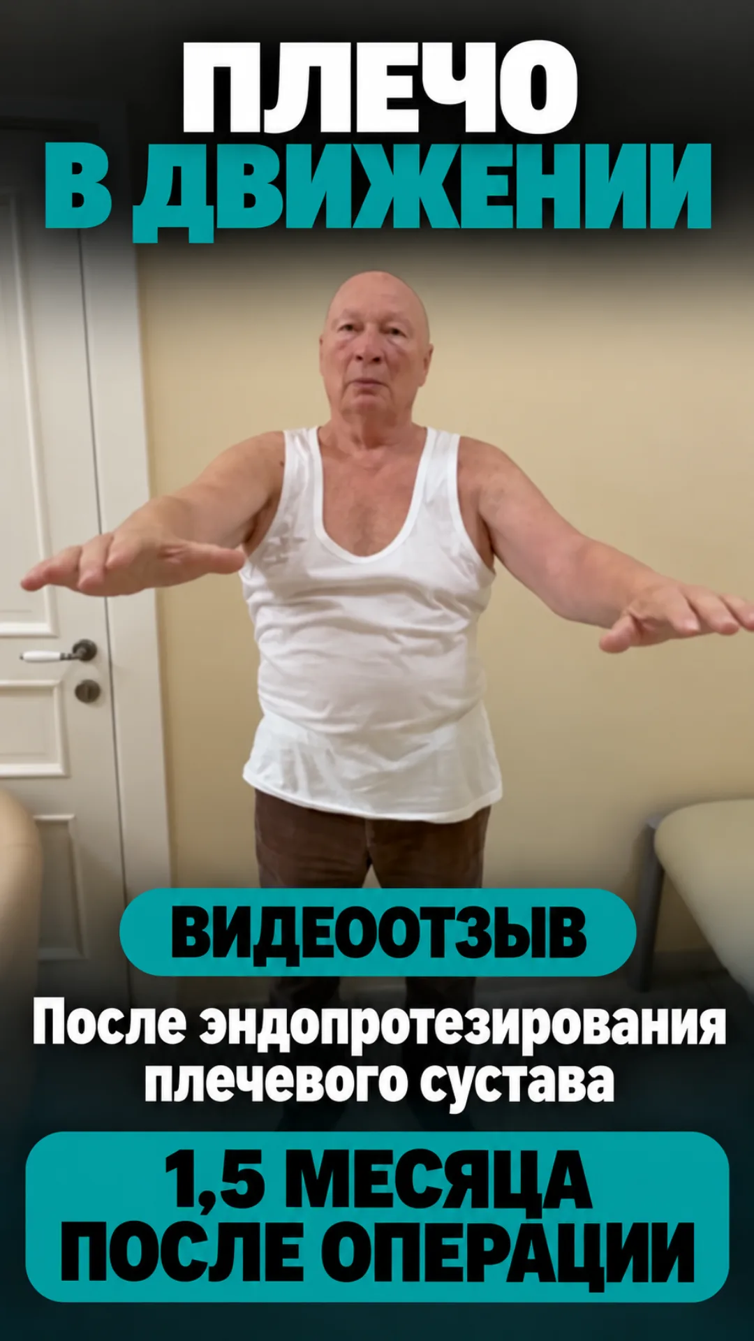 Полтора месяца после эндопротезирования плечевого сустава.