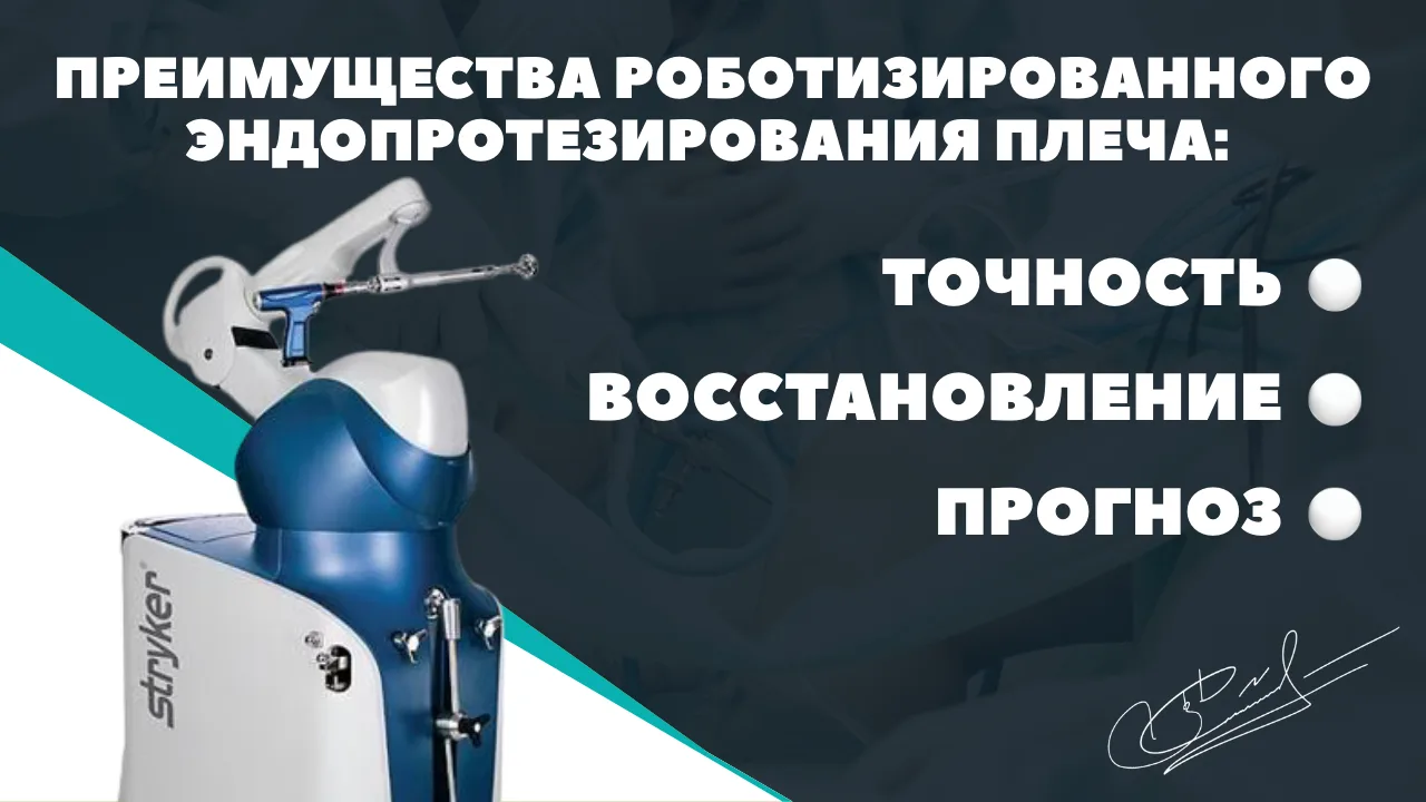 Преимущества роботизированного эндопротезирования плеча: точность, восстановление, прогноз