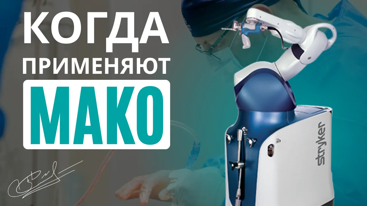 Когда применяется робот Мако при операциях на суставах