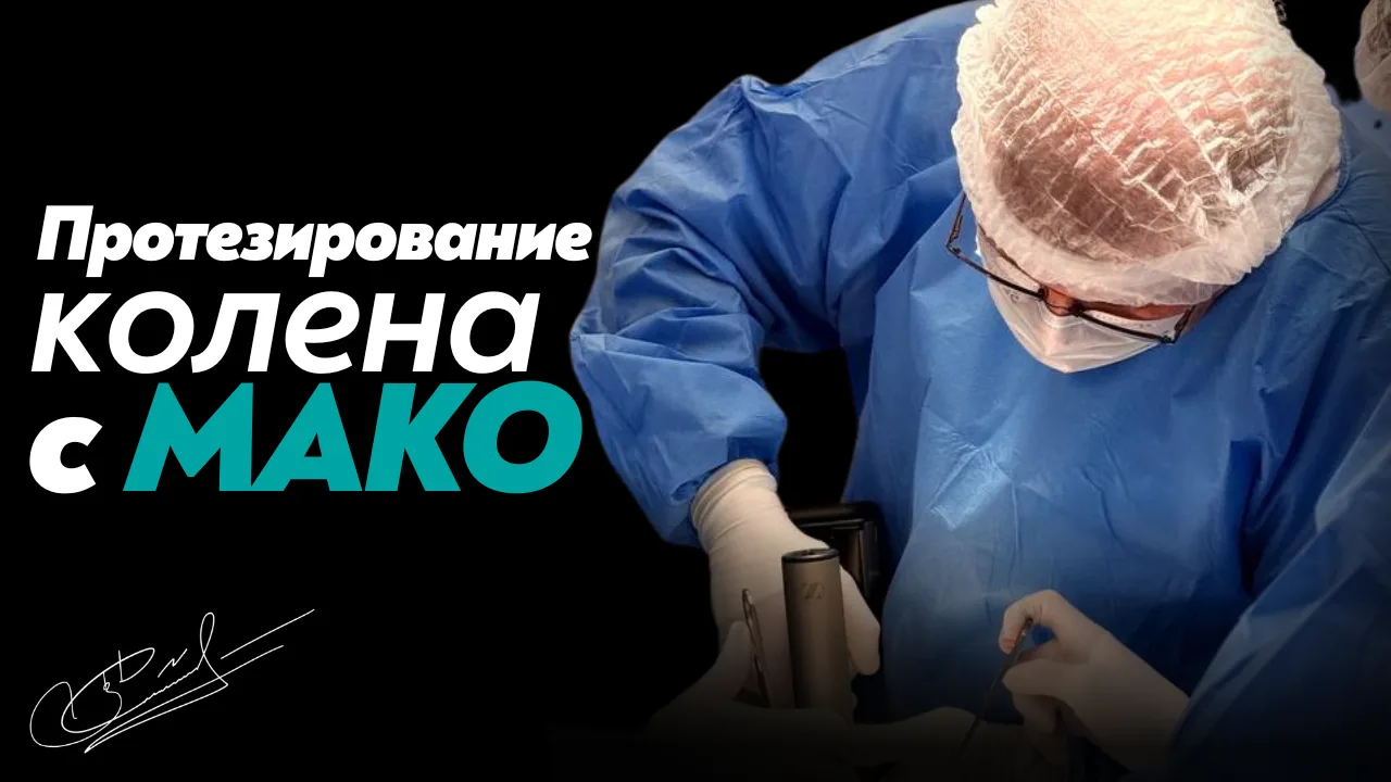 Эндопротезирование коленного сустава с использованием робота Мако