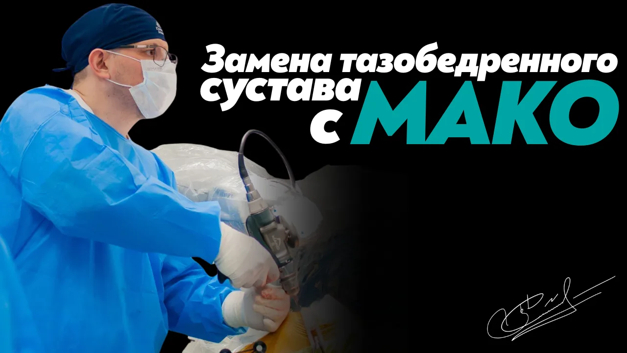 Замена тазобедренного сустава с роботом Мако: особенности операции
