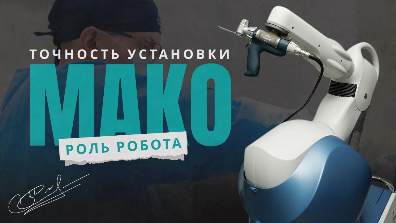 Почему точность установки эндопротеза зависит от планирования: роль робота Мако