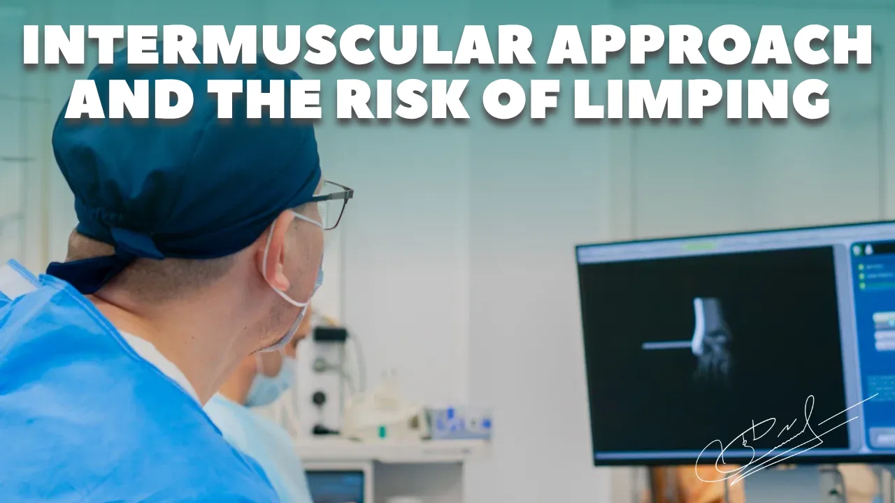 Why does the intermuscular approach reduce the risk of limping after hip replacement?
