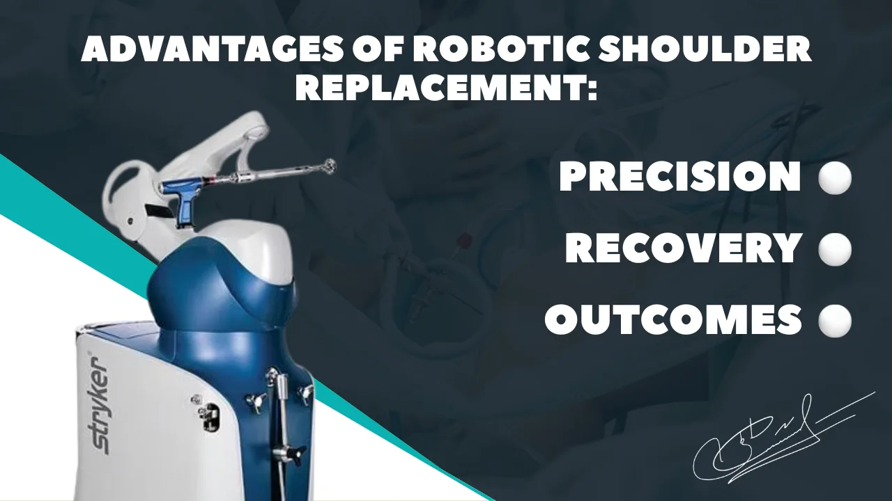 Advantages of robotic shoulder replacement: precision, recovery, and outcomes