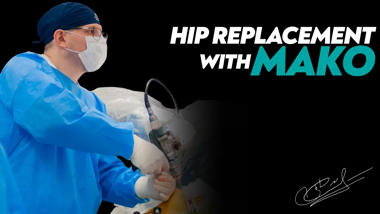 Hip Replacement with the Mako Robot: Surgical Features