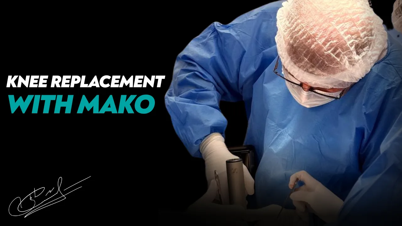 Knee Replacement Using the Mako Robot