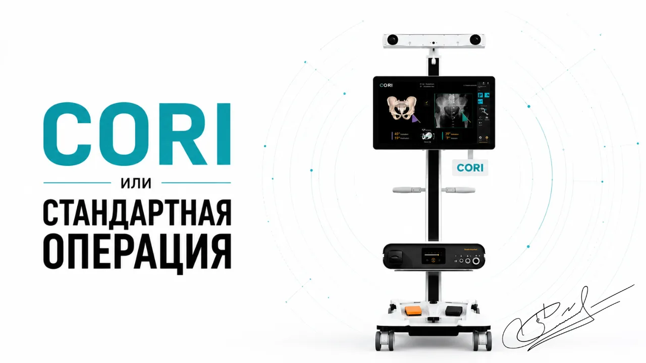 How CORI Differs From Standard Knee Replacement